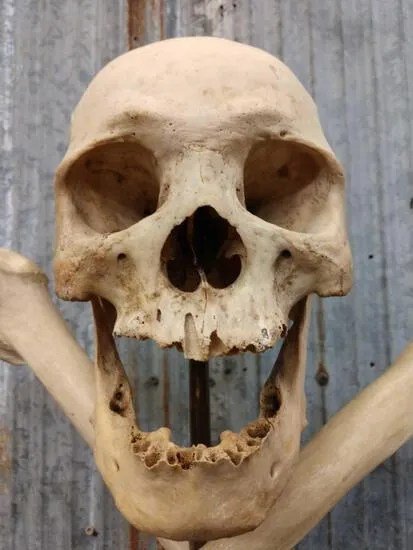 Oddities Real Human Skull with Femur Bones on Brass Stand - Image 3