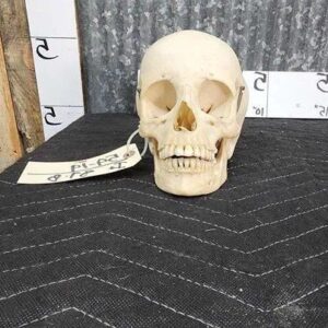 Real Human Skull Oddities Complete