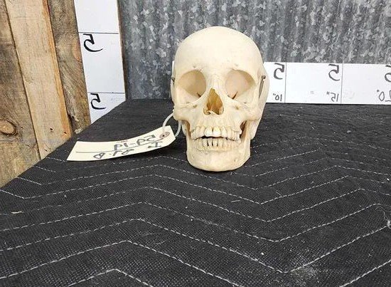 Real Human Skull Oddities Complete