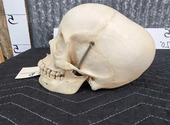 Real Human Skull Oddities Complete - Image 3