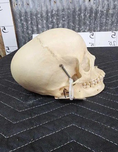 Real Human Skull Oddities Complete - Image 2