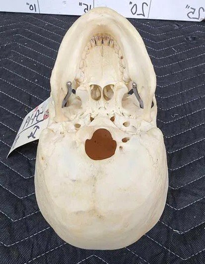 Real Human Skull Oddities Complete - Image 5